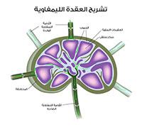  خزعة العقد الليمفاوية 