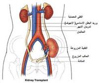 زراعة الكلى