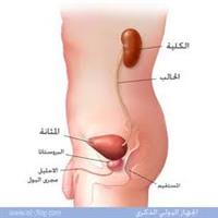 إلتهاب المسالك البولية