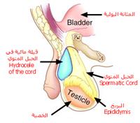 انتفاخ أو ورم الخصية - الأسباب والدلائل
