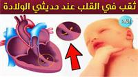  أنواع ثقب القلب عند الأطفال 