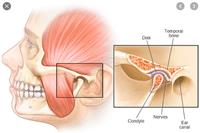 ما هي اضطرابات المفصل الفكي الصدغي