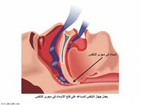 الحمية والتمارين مهمتان لمرضى توقف التنفس