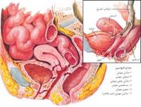 ناسور مهبلي