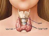  قصور الغدة الدرقية.