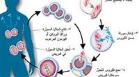 زواج الأقارب والإنجاب في سن متأخرة. 