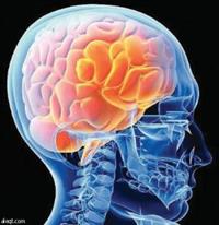 الاستسقاء من أخطر أمراض المخ والأعصاب التي تصيب 