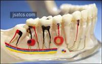 أسباب التهاب لب الأسنان وكيفية علاجه.. مضاعفاته 