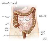 ما هو تدَلّي المُستقيم؟