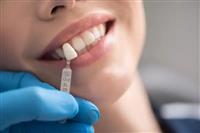 كيف تختار تلبيس اسنان مناسب لك ؟
