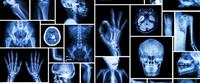 فوائد ومخاطر الأشعة السينية 