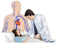 أعراض حساسية الصدرية عند الأطفال