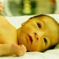  هل مرض اليرقان خطير على الرضع؟