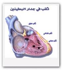 الثقوب في القلب.. أشهر العيوب الخلقية لدى الأطفال