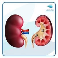  علاج عدم اكتمال الرئة عند حديثي الولادة,,,,.