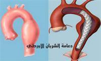 «متحور كورونا».. هل توقف انتشارا أم يمارس «استراحة