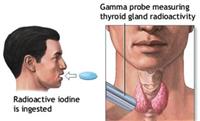 الفحص النووي للغدة الدرقية لايسبب أعراضا جانبية 