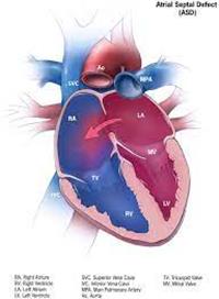 الاعتلالات القلبية القنوية
