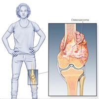 إهدار 2.2 مليار دولار لتجميل الخليجيات سنوياً.. 