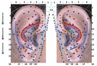 العلاج التحفیزي من خلال صیوان الأذن