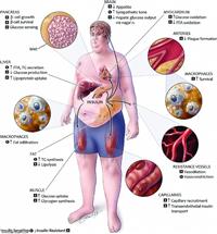 مستقبلات الإنسولين.عطبها هل يؤثر في عمل المخ ووظ