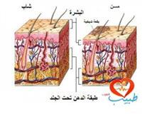 بقع الشيخوخة أسبابها وعلاجها والوقاية منها