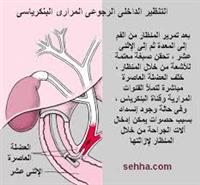 منظار فحص القناة الصفراوية والبنكرياس 