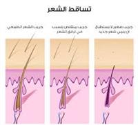 تساقط الشعر أسباب وعلاج تساقط الشعر