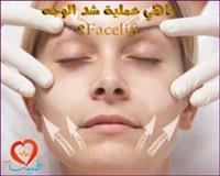 ماهي عملية شد الوجه Facelift ؟