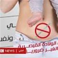 الولادة القيصرية: مضاعفات قد تعانيها الأم وطفلها