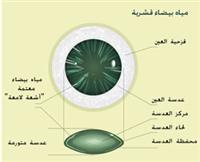 أسباب تكوّن المياه البيضاء؟؟؟