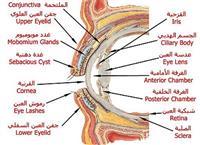 زرع القرنية وكيف تتم العملية